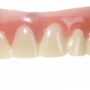 Secure Instant Smile one size fits most